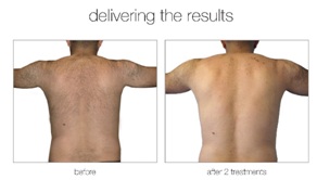 Venus Versa is here! 2 Venus Versa