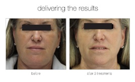 Venus Versa is here! 3 Venus Versa is here!